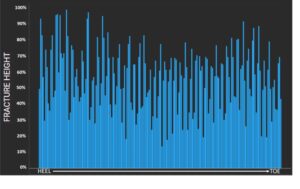 SSD LinkedIn fracture height